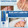 Hot Nail Fungal Pen Anti Fungus Blue Light Laser Pen Onychomycosis Painless Nail Repair Pen Nail Care Repair Serum